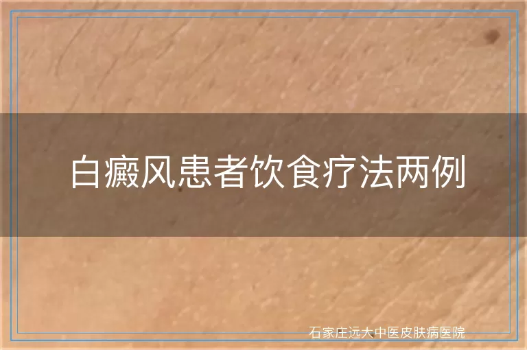 白癜风患者饮食疗法两例