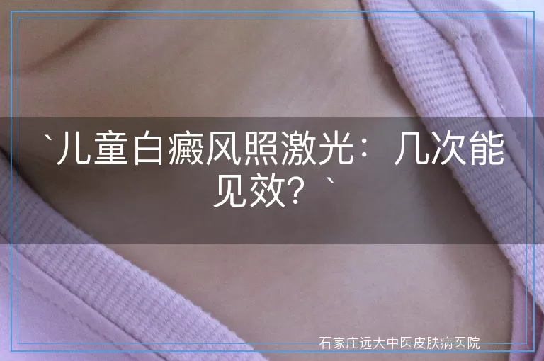 儿童白癜风照激光:几次能见效?