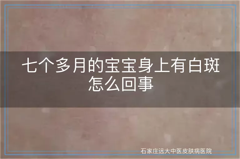 七个多月的宝宝身上有白斑怎么回事
