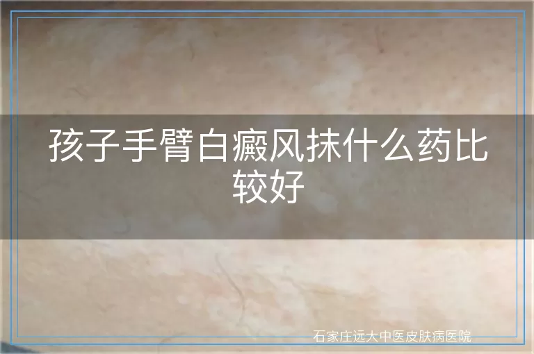 孩子手臂白癜风抹什么药比较好
