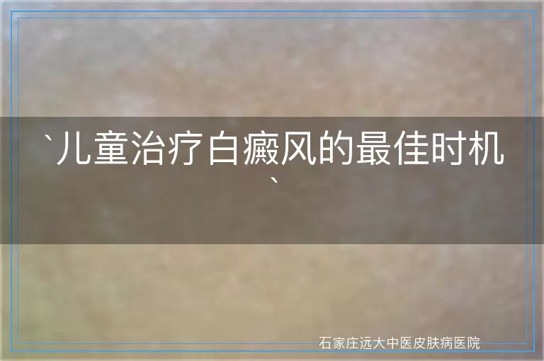 儿童治疗白癜风的最佳时机