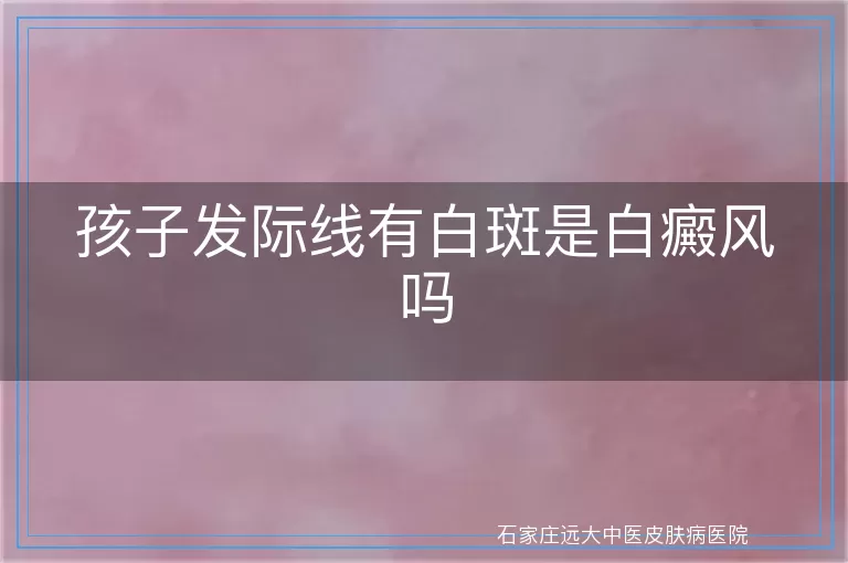 孩子发际线有白斑是白癜风吗