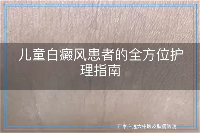 儿童白癜风患者的全方位护理指南