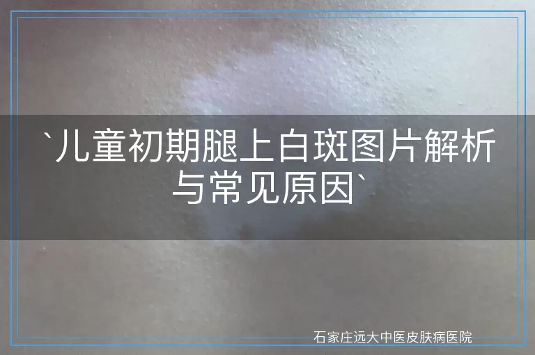 儿童初期腿上白斑图片解析与常见原因