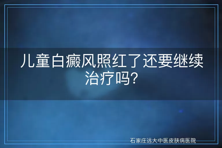 儿童白癜风照红了还要继续治疗吗？