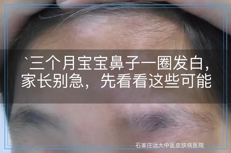 三个月宝宝鼻子一圈发白，家长别急，先看看这些可能的原因