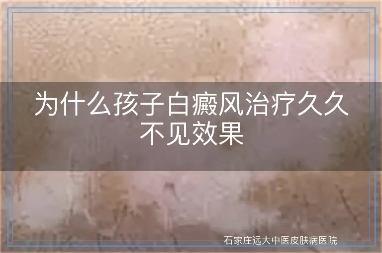 为什么孩子白癜风治疗久久不见效果