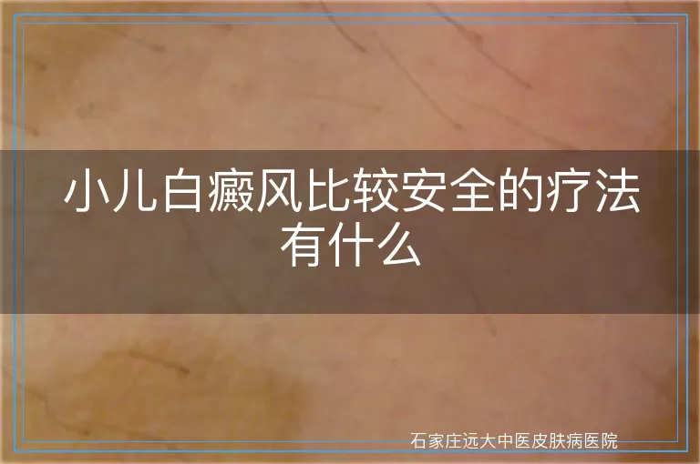 小儿白癜风比较安全的疗法有什么