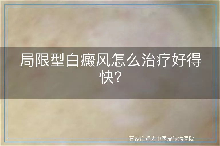 局限型白癜风怎么治疗好得快？