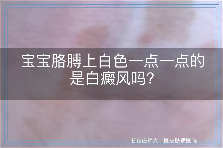 宝宝胳膊上白色一点一点的是白癜风吗?