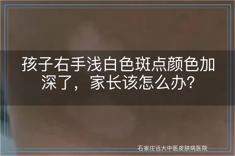孩子右手浅白色斑点颜色加深了,家长该怎么办?