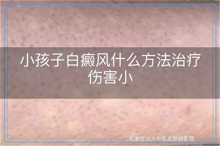 小孩子白癜风什么方法治疗伤害小
