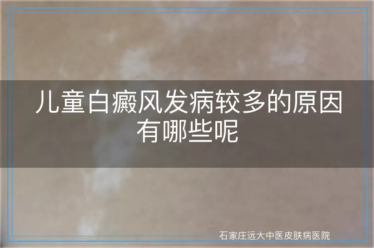 儿童白癜风发病较多的原因有哪些呢