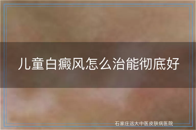 儿童白癜风怎么治能彻底好