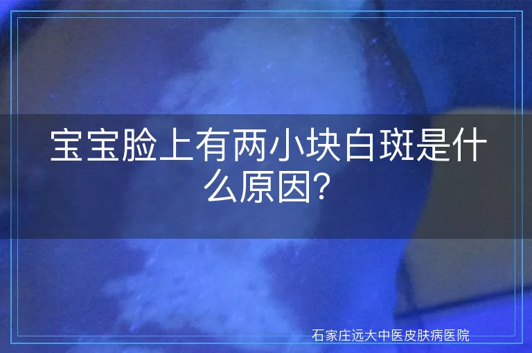 宝宝脸上有两小块白斑是什么原因？