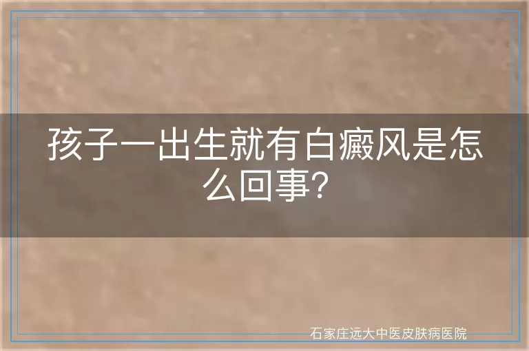 孩子一出生就有白癜风是怎么回事？