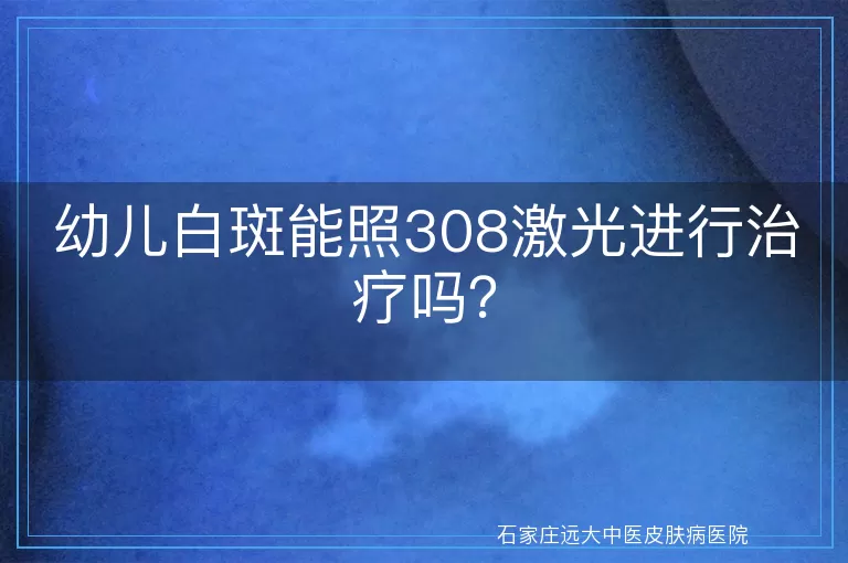 幼儿白斑能照308激光进行治疗吗？