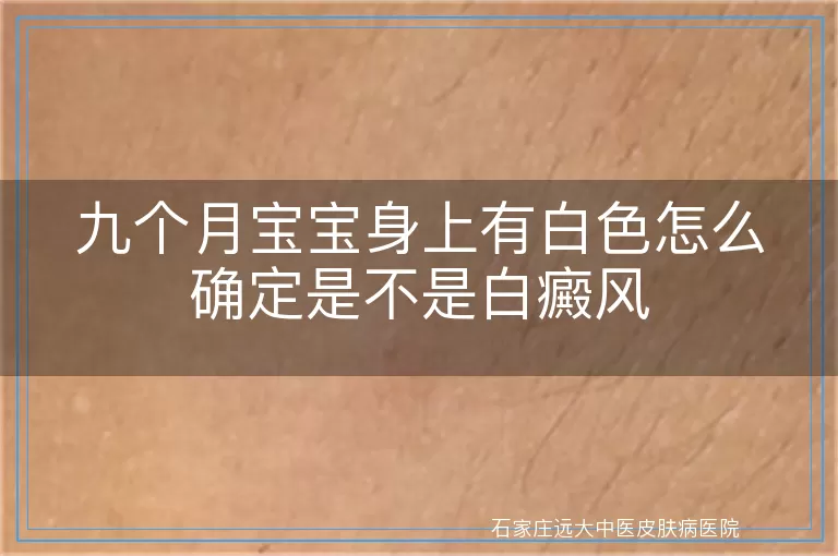 九个月宝宝身上有白色怎么确定是不是白癜风