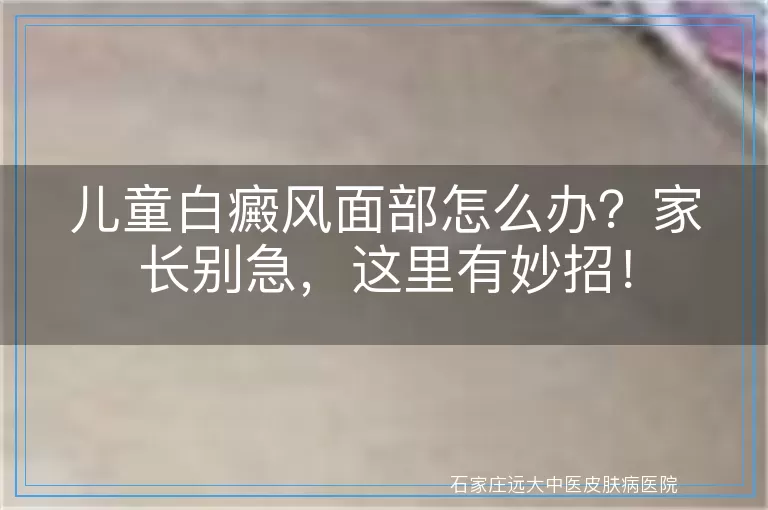 儿童白癜风面部怎么办？家长别急，这里有妙招！