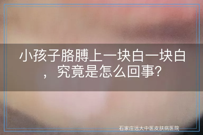 小孩子胳膊上一块白一块白，究竟是怎么回事？
