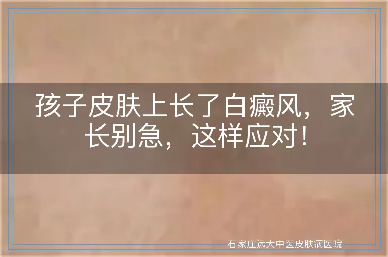 孩子皮肤上长了白癜风，家长别急，这样应对！