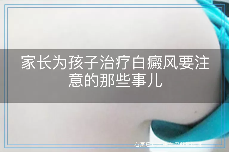 家长为孩子治疗白癜风要注意的那些事儿