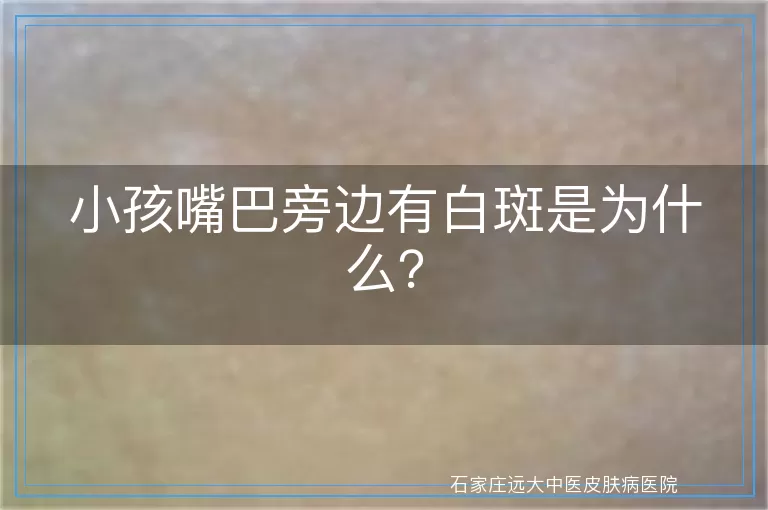 小孩嘴巴旁边有白斑是为什么？