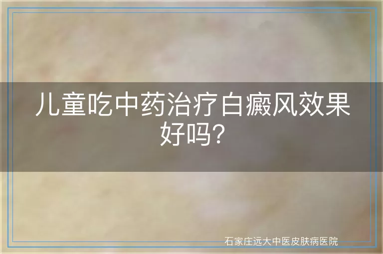 儿童吃中药治疗白癜风效果好吗？