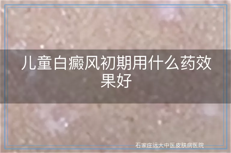 儿童白癜风初期用什么药效果好