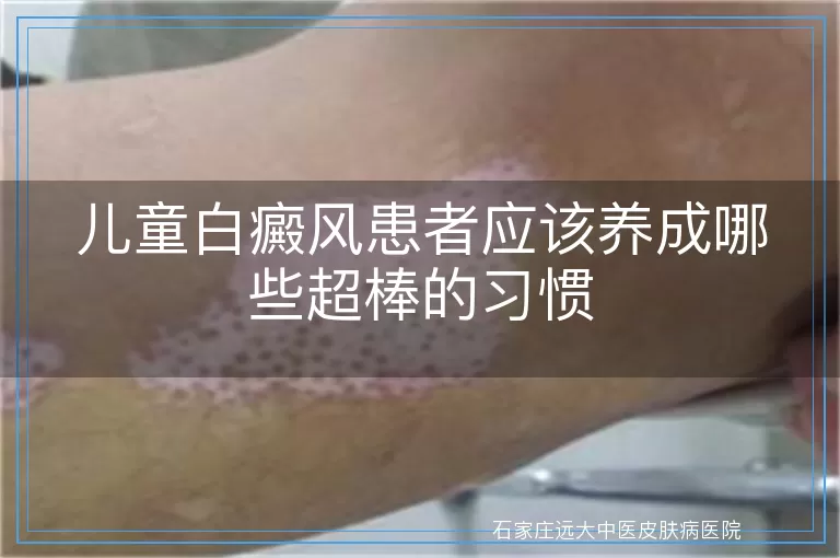 儿童白癜风患者应该养成哪些超棒的习惯