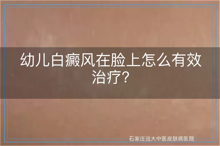幼儿白癜风在脸上怎么有效治疗？