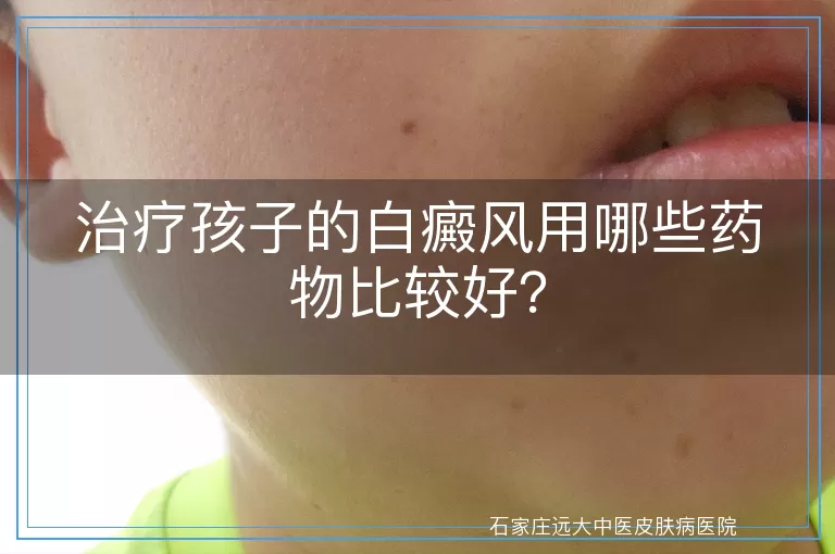 治疗孩子的白癜风用哪些药物比较好？