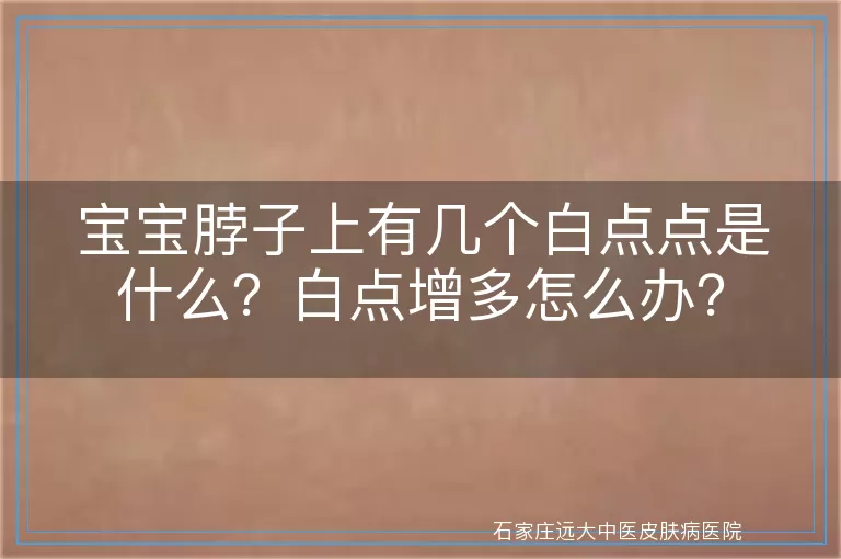 宝宝脖子上有几个白点点是什么?白点增多怎么办?