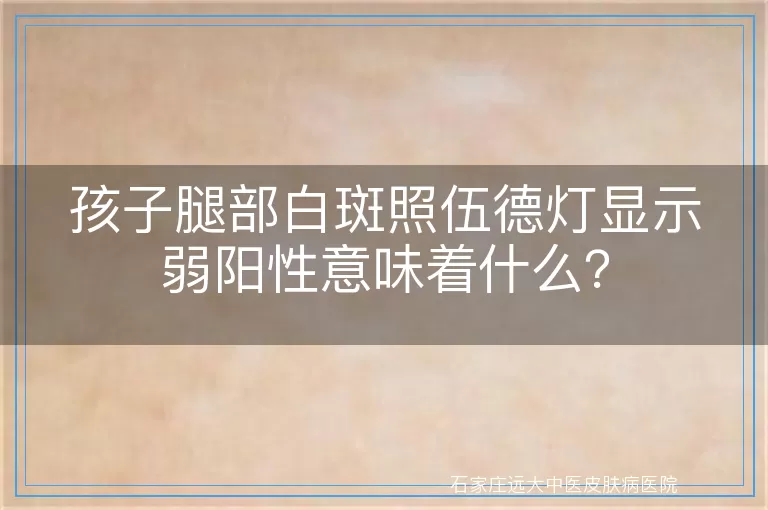 孩子腿部白斑照伍德灯显示弱阳性意味着什么？