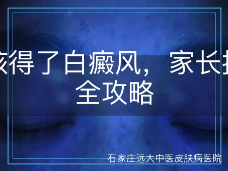 小孩得了白癜风，家长护理全攻略