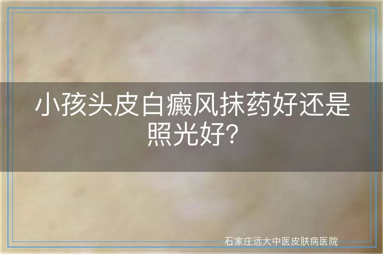 小孩头皮白癜风抹药好还是照光好？