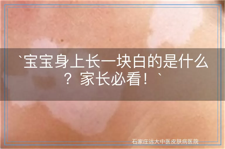 宝宝身上长一块白的是什么？家长必看！