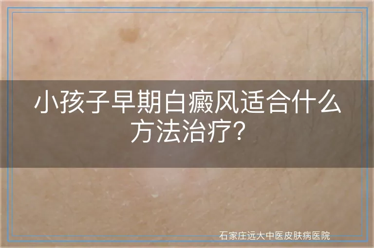 小孩子早期白癜风适合什么方法治疗？