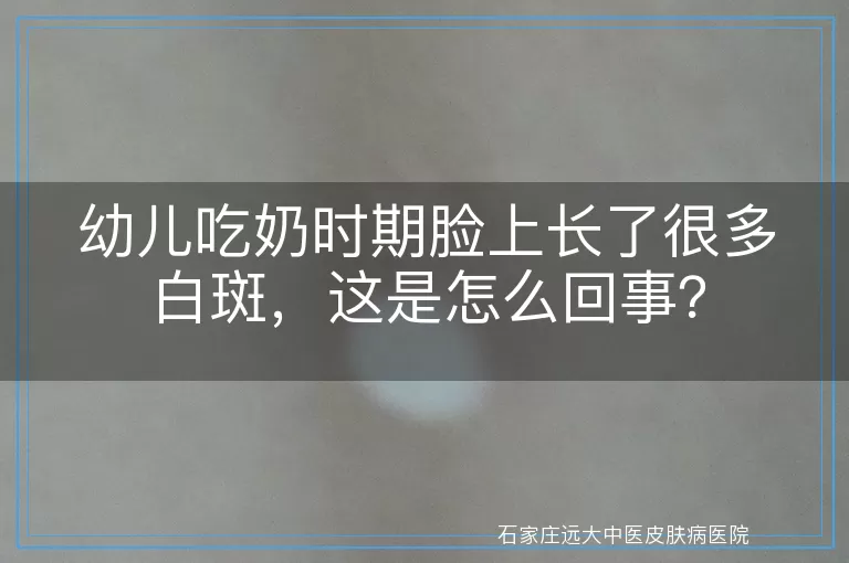 幼儿吃奶时期脸上长了很多白斑，这是怎么回事？