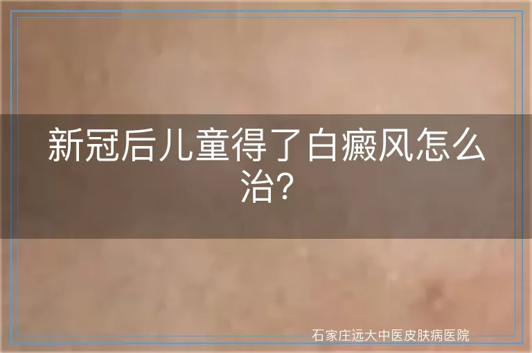 新冠后儿童得了白癜风怎么治？
