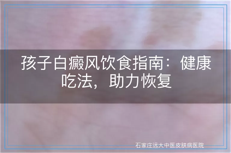 孩子白癜风饮食指南：健康吃法，助力恢复