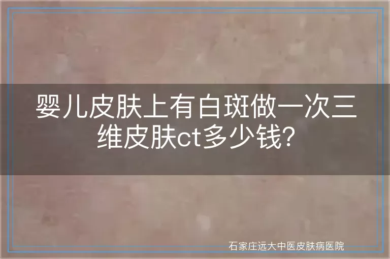婴儿皮肤上有白斑做一次三维皮肤ct多少钱？