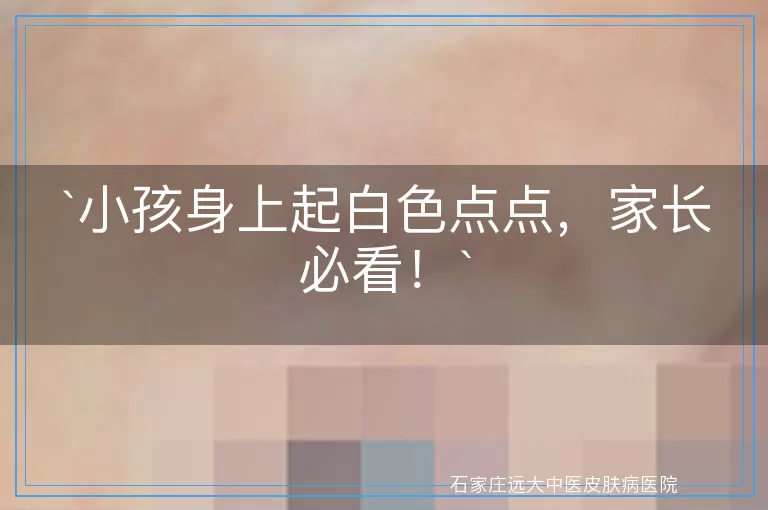 小孩身上起白色点点，家长必看！