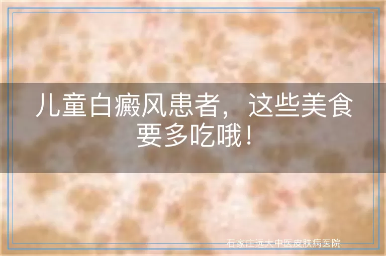 儿童白癜风患者，这些美食要多吃哦！