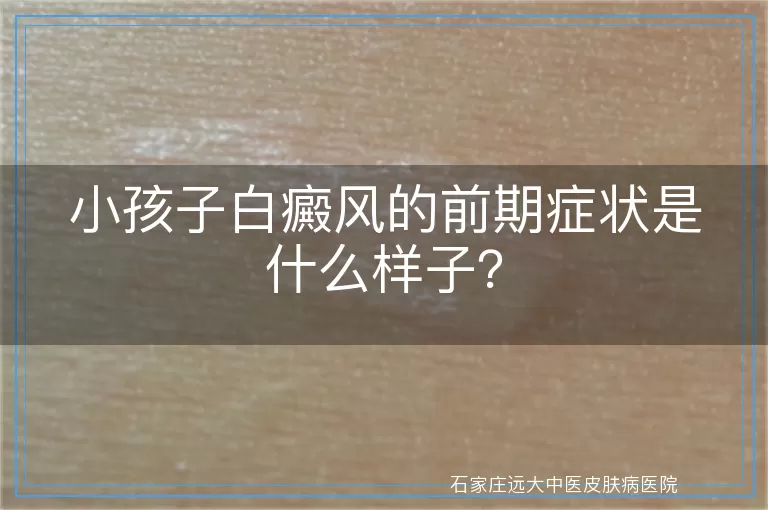 小孩子白癜风的前期症状是什么样子？