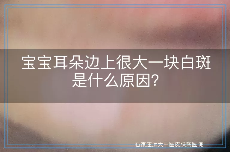 宝宝耳朵边上很大一块白斑是什么原因？