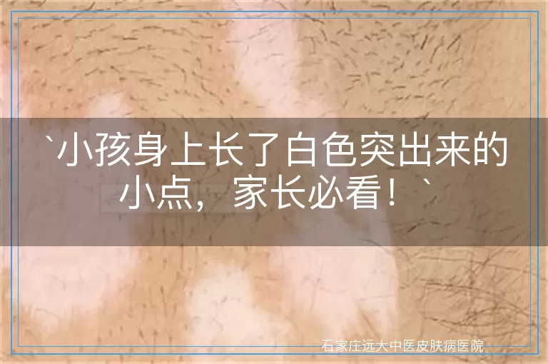 小孩身上长了白色突出来的小点，家长必看！