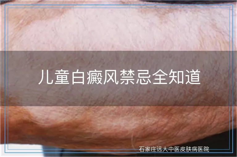 儿童白癜风禁忌全知道