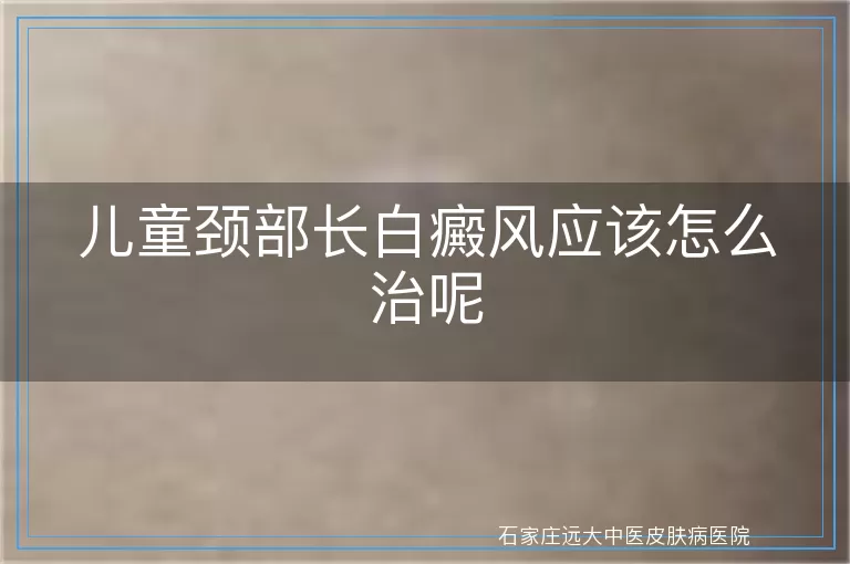 儿童颈部长白癜风应该怎么治呢