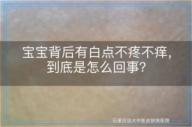 宝宝背后有白点不疼不痒,到底是怎么回事?